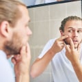 Organic Skincare for Men: Get Rid of Breakouts and Blemishes