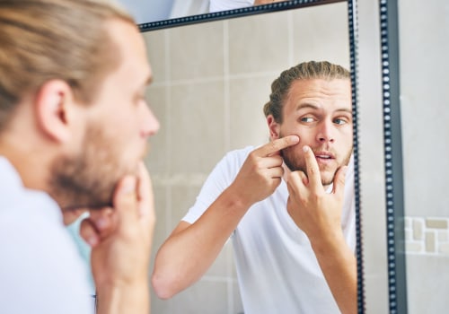 Organic Skincare for Men: Get Rid of Breakouts and Blemishes
